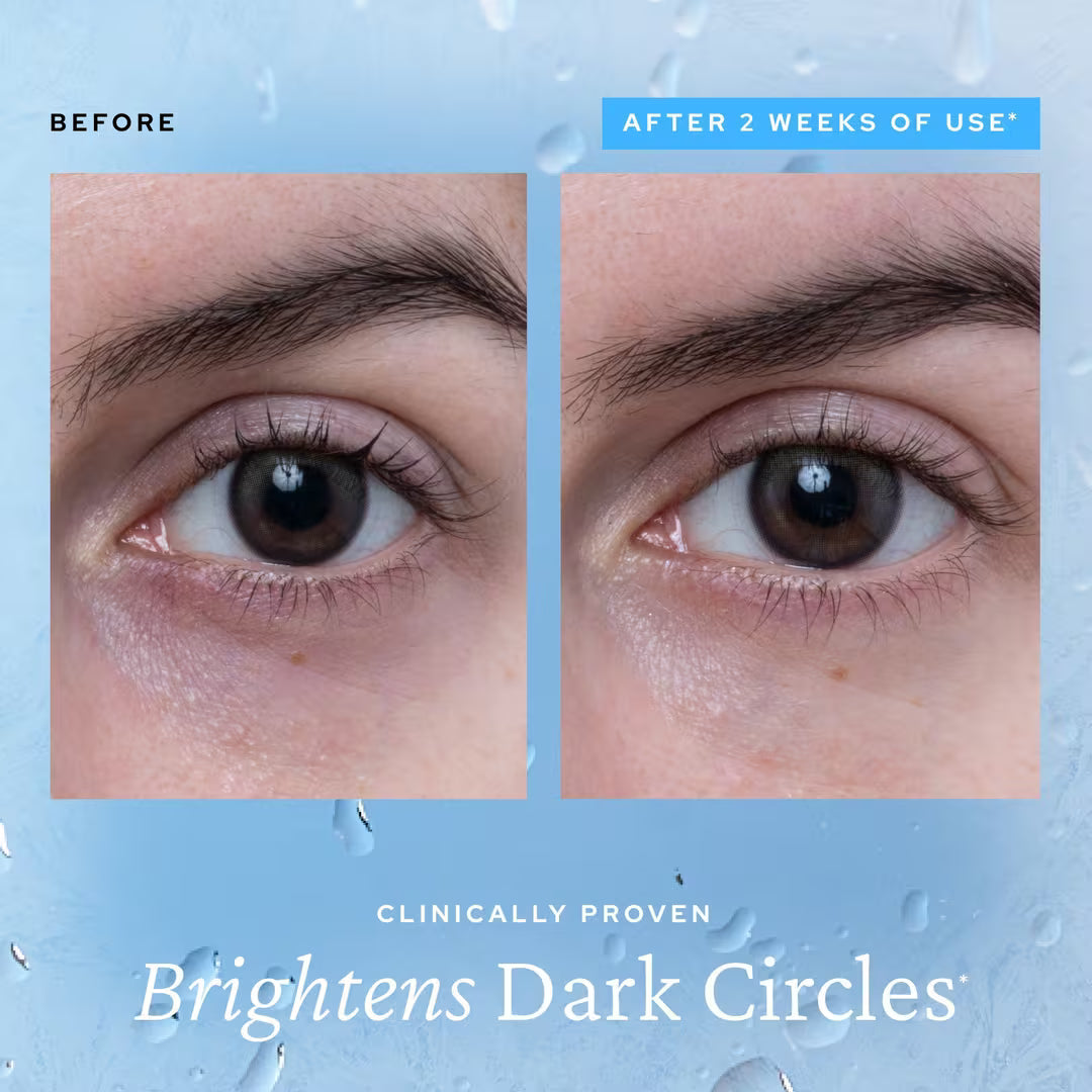 The Aqua Bomb Eye Gel - Depuff Eyes in 3 Minutes + 50% OFF