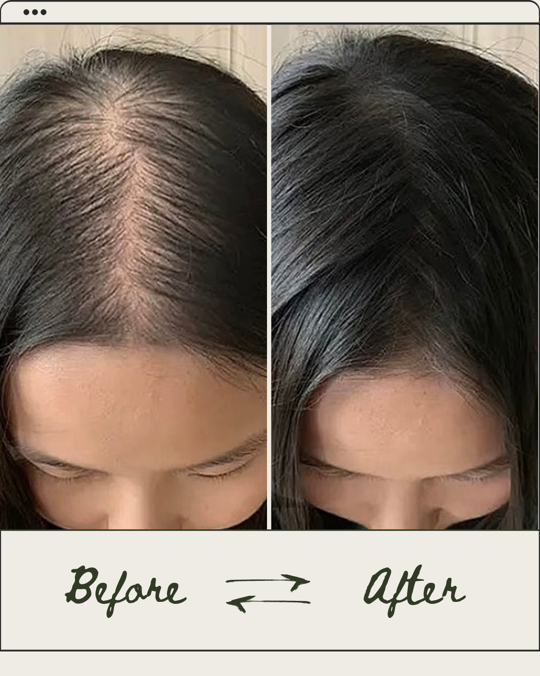 VerdantRoots — Wake Up Dormant Follicles Instantly + 50% OFF