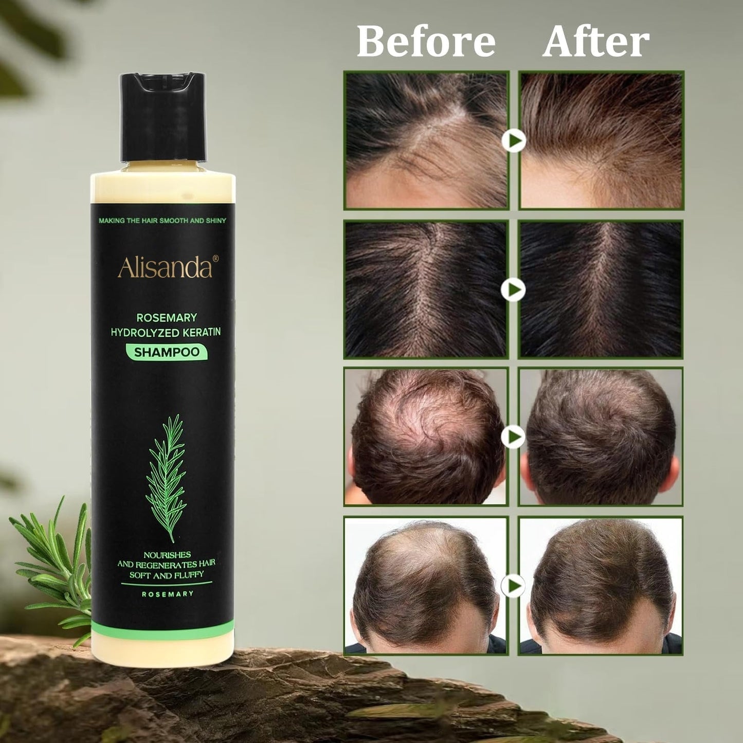 The AuraRoot Rosemary Shampoo - Organic Hair Growth, Hydrolyzed Keratin, and Thickening Formula + 50% OFF