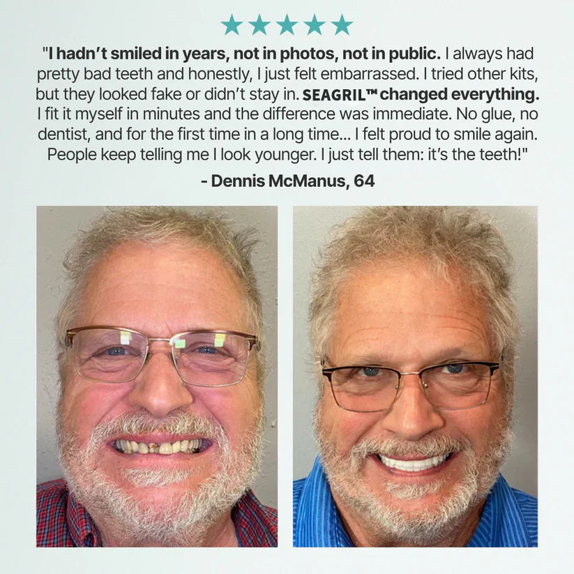 The FlexFit Adaptive Dentures - Custom Fit, Functional, and Natural Look + 50% OFF