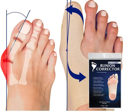 Stridewell™ – Ultra-Thin Bunion Corrector Sleeve for Big Toe Alignment & All-Day Comfort + 50% OFF