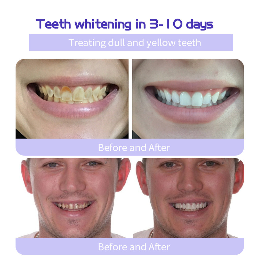 Odalit – Rebuild Gums & Save Teeth + 50% OFF