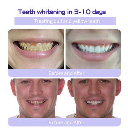 Odalit – Rebuild Gums & Save Teeth + 50% OFF