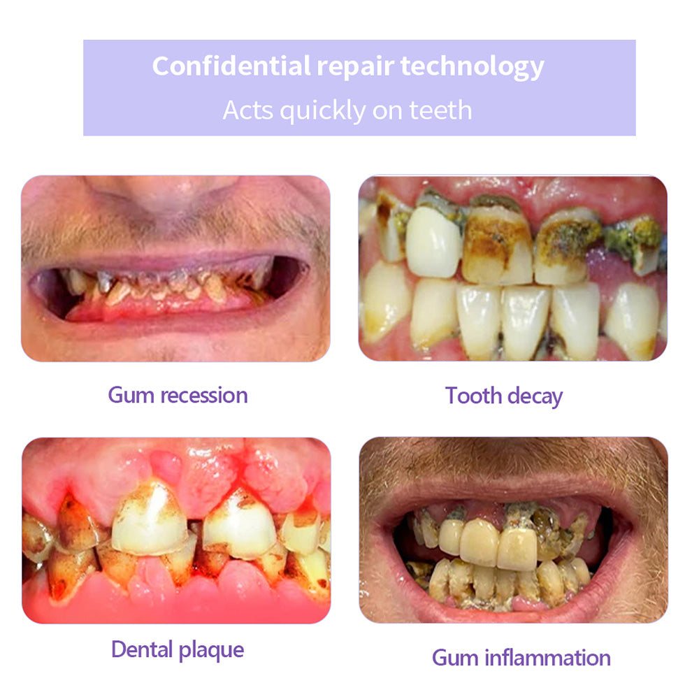Odalit – Rebuild Gums & Save Teeth + 50% OFF