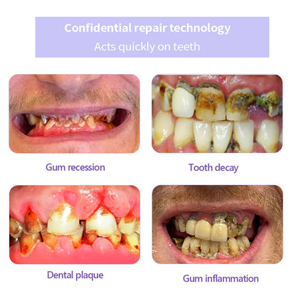 Odalit – Rebuild Gums & Save Teeth + 50% OFF