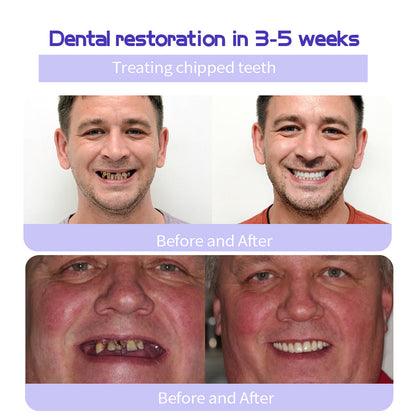 Odalit – Rebuild Gums & Save Teeth + 50% OFF
