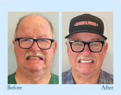 BBOJI  LUXURY LIFT TOOTHPASTE. ENDS TONIGHT: GET 50% OFF!