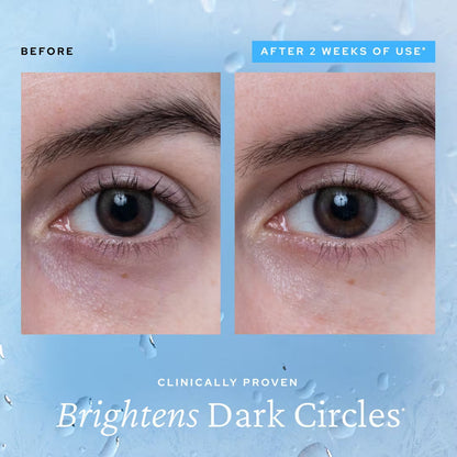 The Aqua Bomb Eye Gel - Depuff Eyes in 3 Minutes + 50% OFF