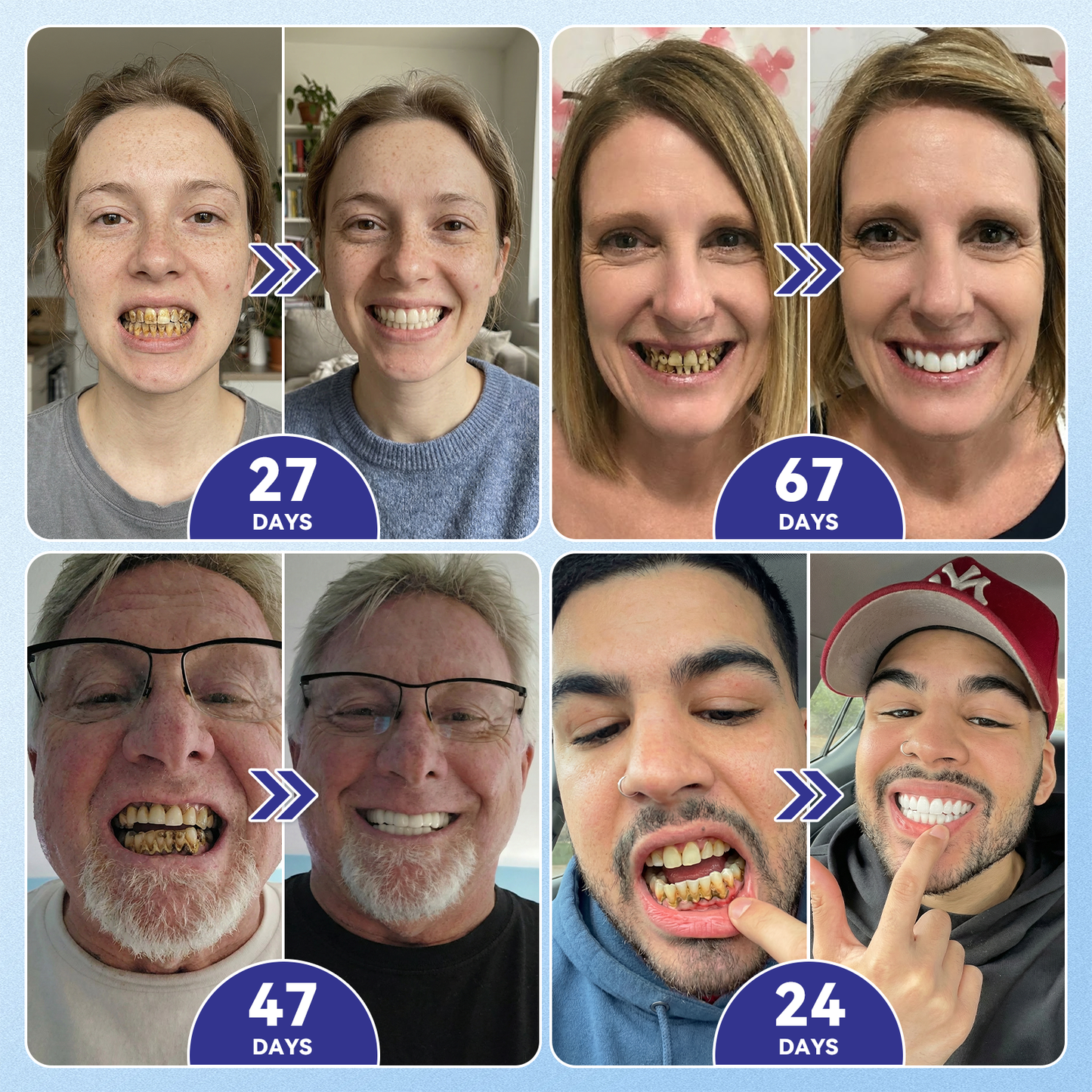 The AuraGlimmer Regeneration Patch — Advanced Tooth & Gum Repair + 50 % OFF