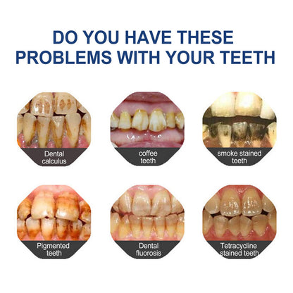 BBOJI  LUXURY LIFT TOOTHPASTE. ENDS TONIGHT: GET 50% OFF!