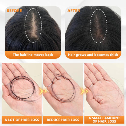 The Root-Strength Shampoo - Thicker Hair, Less Hair Fall + 50% OFF