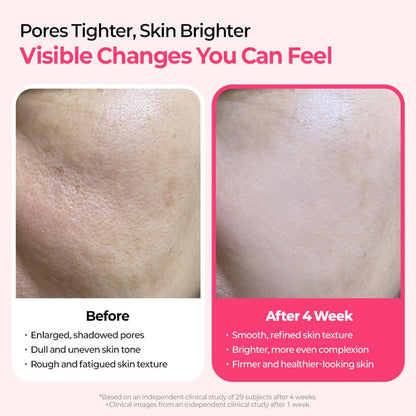 PoreTect Duo - Resurface Your Skin, Erase Imperfections - 50% OFF