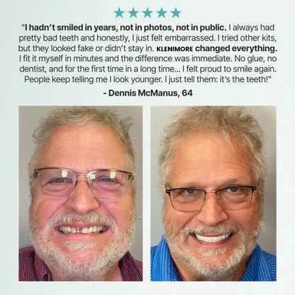 The AdaptableFit Dentures - Custom Fit, Functional, and Natural Look + 50% OFF