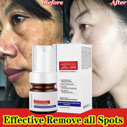 LumaBright - Erase Spots, Reveal Radiance - 50% OFF