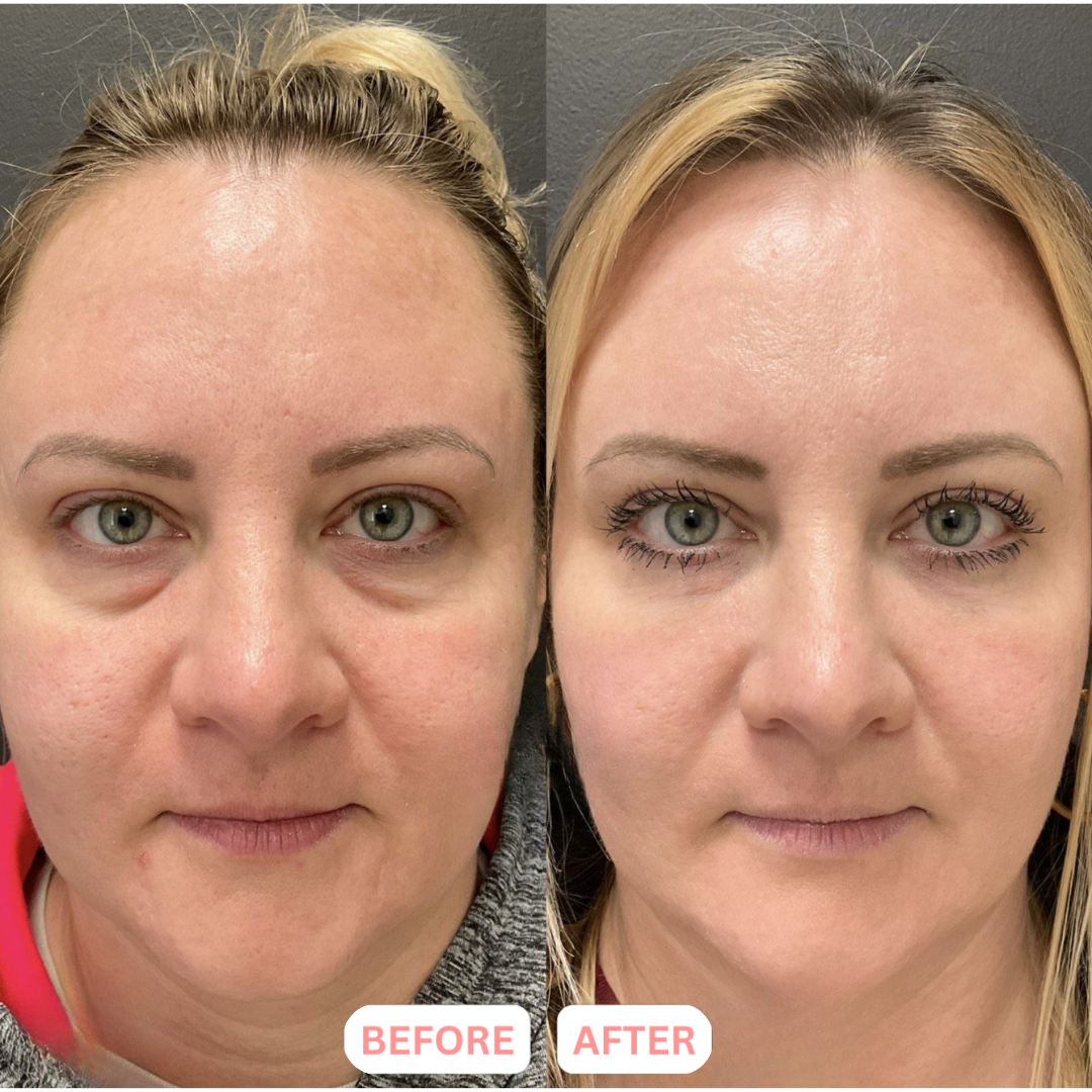 The ContourLift Face Brush - Eliminate Double Chin & Reduce Puffiness + 50% OFF