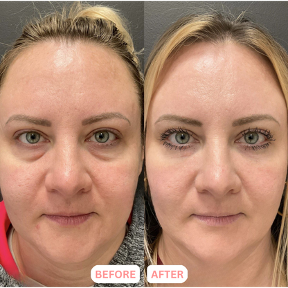 The ContourLift Face Brush - Eliminate Double Chin & Reduce Puffiness + 50% OFF