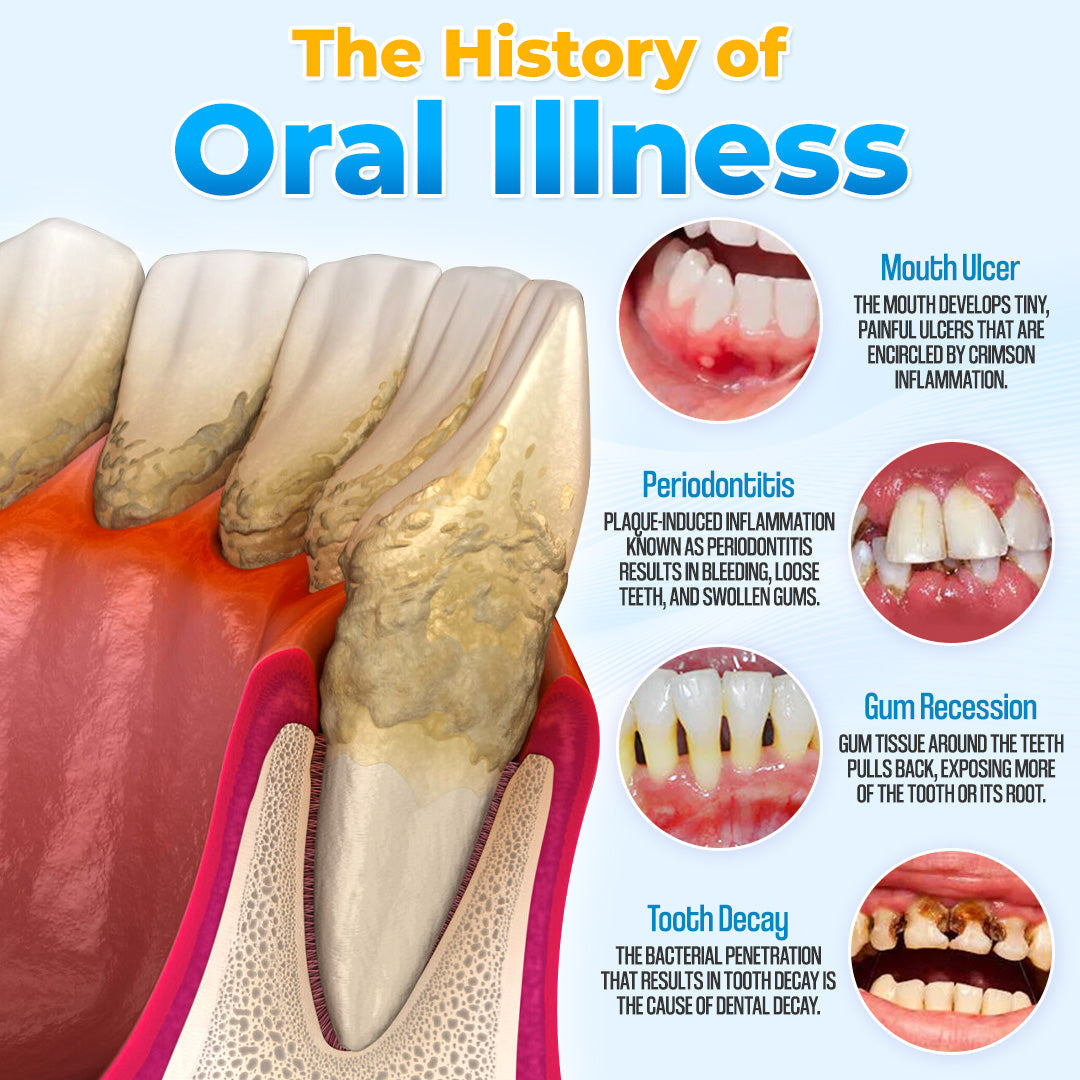 The MicroSmile Gum Restoration Kit - Bee Venom Mousse, Tongue Scraper, and FDA-Approved Healing + 50% OFF