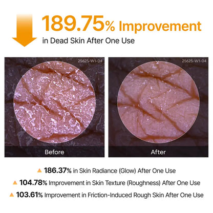 The Radiance Peel Spray - Smooth Bumps, Instant Glow + 50% OFF