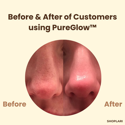 The PureGlow  Black Tea Mask - A Total Skin Reset in a Jar + 1+1 FREE
