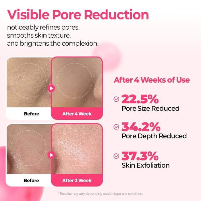 PoreTect Duo - Resurface Your Skin, Erase Imperfections - 50% OFF