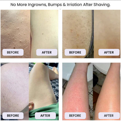 The Smooth Shave Razor - Silky Smooth Skin, Guaranteed. + 50% OFF