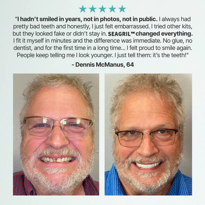 The InstaSmile Custom Dentures - Smile With Confidence Again + ENDS TODAY + 50% OFF