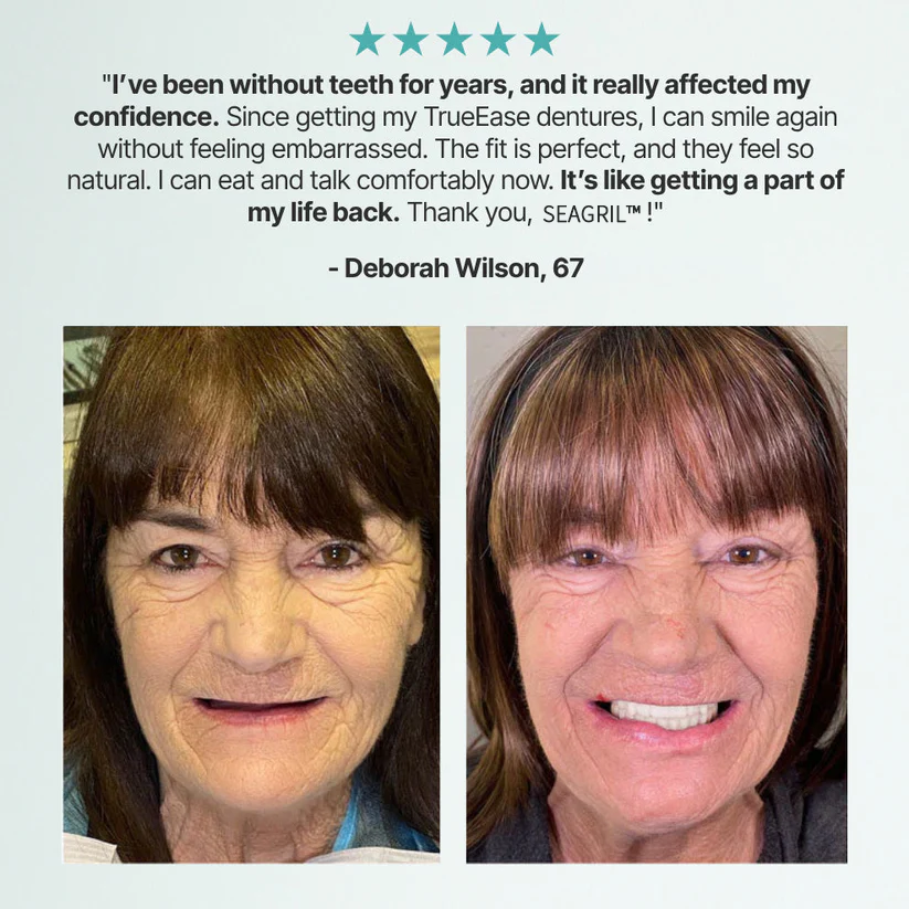 The InstaSmile Custom Dentures - Smile With Confidence Again + ENDS TODAY + 50% OFF