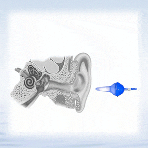 The AquaSeal™ Inflatable Earplug - A Perfect Seal, Every Time + 50% OFF