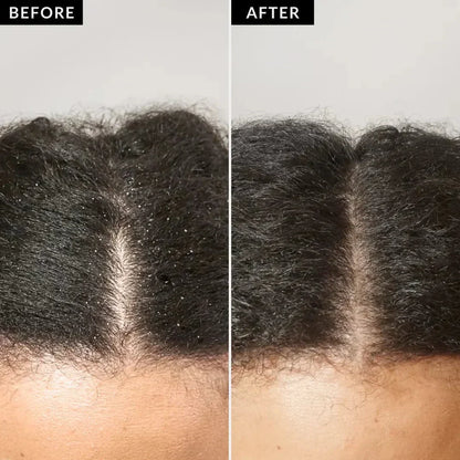 True-Roots Purifying Comb - End Flakes, Stop Itch - 50% OFF