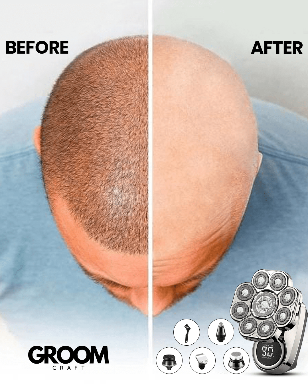 The ApexSeries Shaving Kit - 9 Blades Cut Prep Time to Seconds + 50% OFF