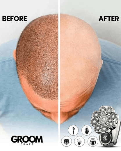 The ApexSeries Shaving Kit - 9 Blades Cut Prep Time to Seconds + 50% OFF